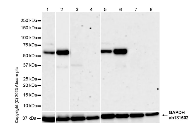 Western blot - Anti-Tyrosine Hydroxylase antibody [RM1085] - BSA and Azide free (AB315253)