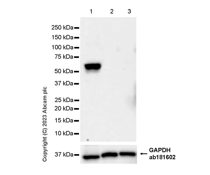 Western blot - Anti-Tyrosine Hydroxylase antibody [RM1085] - BSA and Azide free (AB315253)