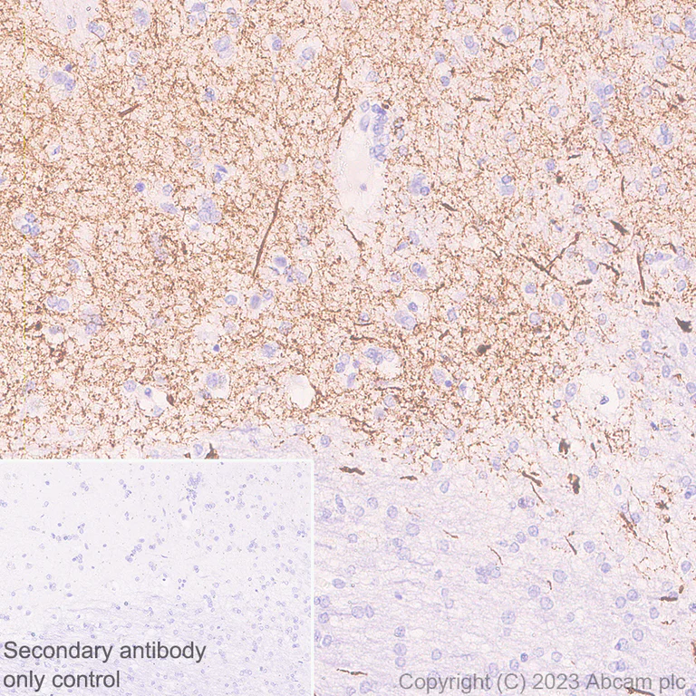 Immunohistochemistry (Formalin/PFA-fixed paraffin-embedded sections) - Anti-Tyrosine Hydroxylase antibody [RM1085] - Neuronal Marker (AB315252)