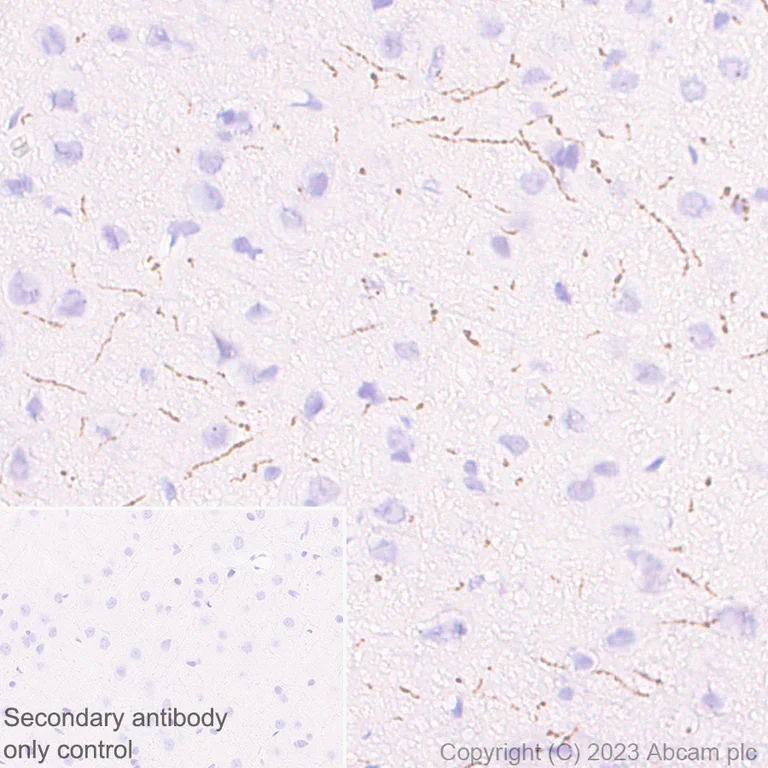 Immunohistochemistry (Formalin/PFA-fixed paraffin-embedded sections) - Anti-Tyrosine Hydroxylase antibody [RM1085] - Neuronal Marker (AB315252)