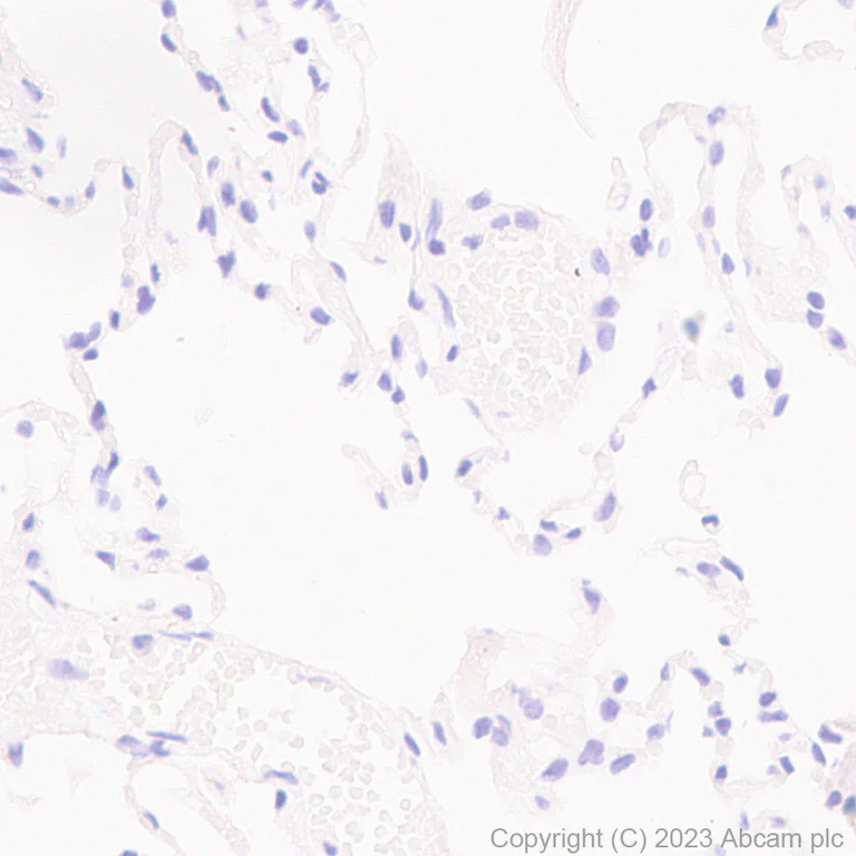 Immunohistochemistry (Formalin/PFA-fixed paraffin-embedded sections) - Anti-Tyrosine Hydroxylase antibody [RM1085] - Neuronal Marker (AB315252)