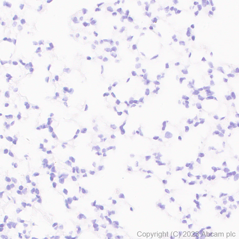 Immunohistochemistry (Formalin/PFA-fixed paraffin-embedded sections) - Anti-Tyrosine Hydroxylase antibody [RM1085] - Neuronal Marker (AB315252)