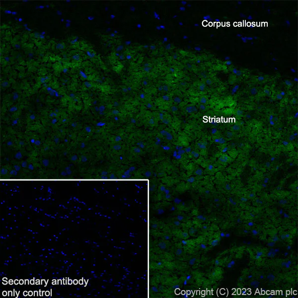 Immunohistochemistry (Frozen sections) - Anti-Tyrosine Hydroxylase antibody [RM1085] - Neuronal Marker (AB315252)