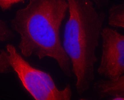 Immunocytochemistry/ Immunofluorescence - Anti-Tyrosine Hydroxylase (phospho S19) antibody (AB194785), expandable thumbnail