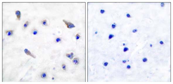 Immunohistochemistry (Formalin/PFA-fixed paraffin-embedded sections) - Anti-Tyrosine Hydroxylase (phospho S19) antibody (AB51194), expandable thumbnail