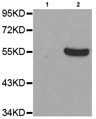 Western blot - Anti-Tyrosine Hydroxylase (phospho S31) antibody (AB194760), expandable thumbnail