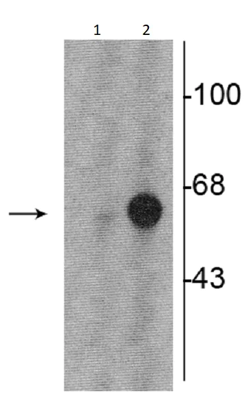 Western blot - Anti-Tyrosine Hydroxylase (phospho S31) antibody (AB254031)