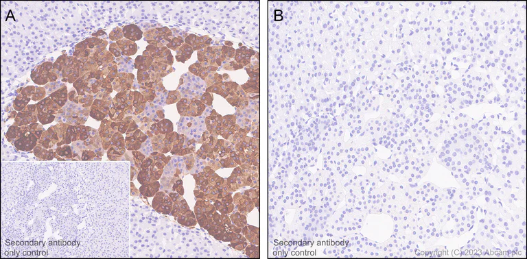 Immunohistochemistry (Formalin/PFA-fixed paraffin-embedded sections) - Anti-Tyrosine Hydroxylase (phospho S31) antibody [EPR26192-116] (AB314484)