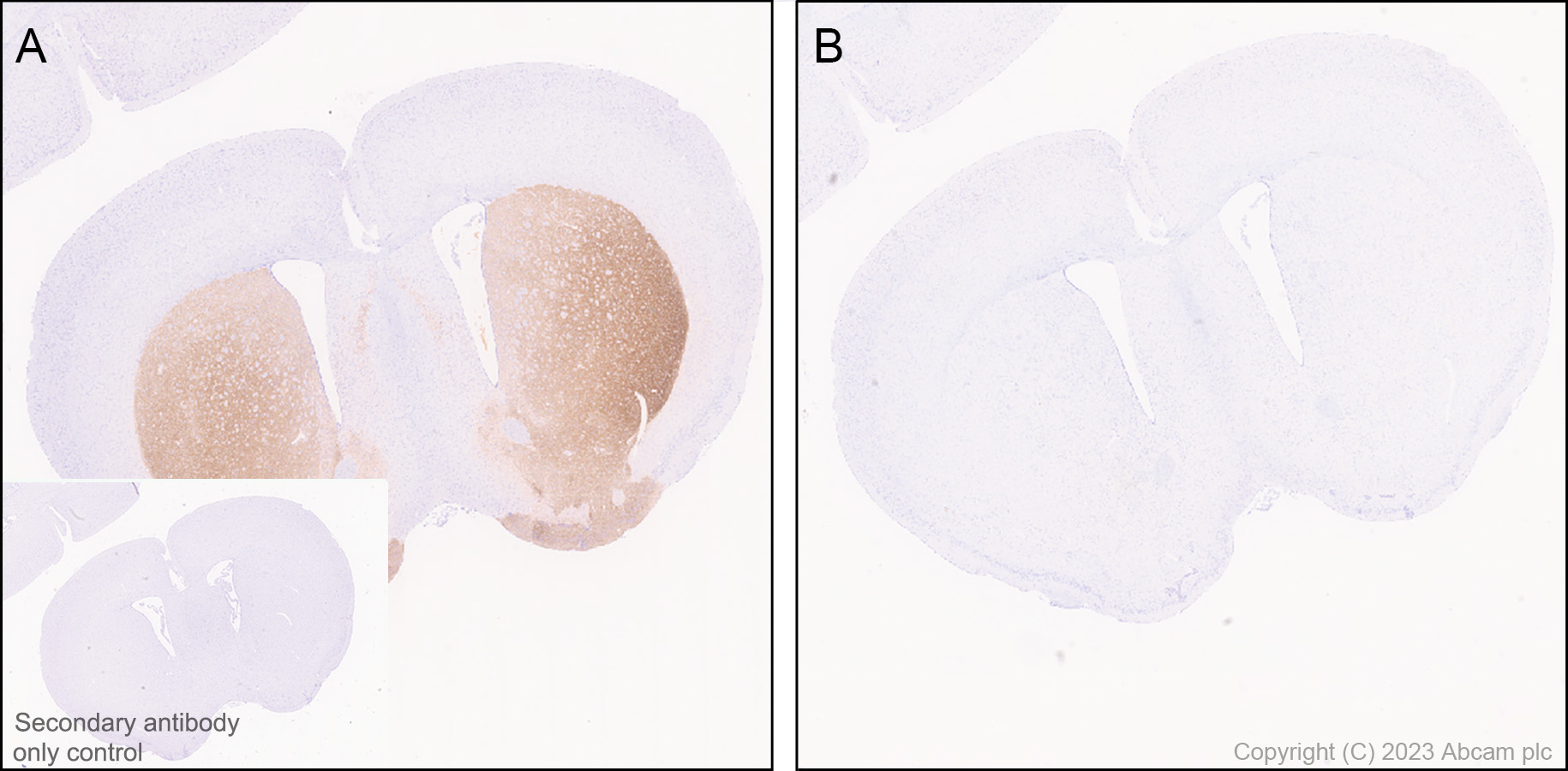 Immunohistochemistry (Formalin/PFA-fixed paraffin-embedded sections) - Anti-Tyrosine Hydroxylase (phospho S31) antibody [EPR26192-116] (ab314484), expandable thumbnail
