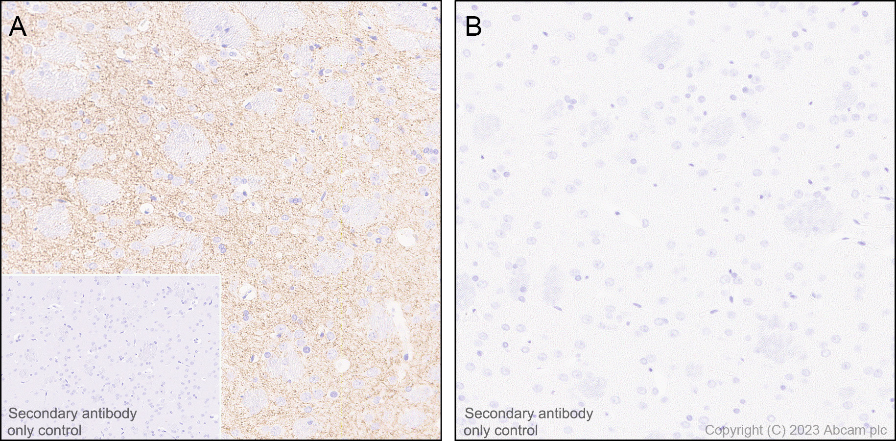 Immunohistochemistry (Formalin/PFA-fixed paraffin-embedded sections) - Anti-Tyrosine Hydroxylase (phospho S31) antibody [EPR26192-116] (AB314484), expandable thumbnail
