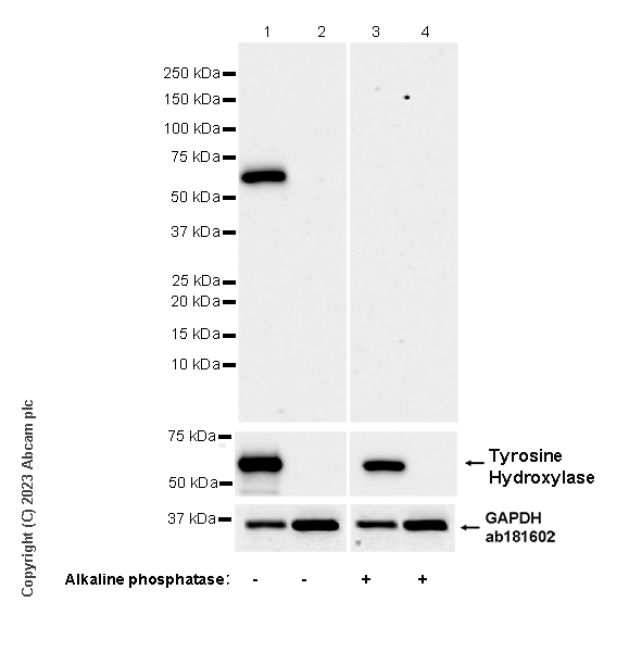 Western blot - Anti-Tyrosine Hydroxylase (phospho S31) antibody [EPR26192-116] (ab314484), expandable thumbnail