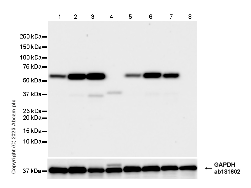 Western blot - Anti-Tyrosine Hydroxylase (phospho S31) antibody [EPR26192-116] (AB314484), expandable thumbnail