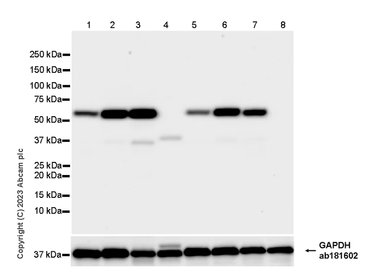 Western blot - Anti-Tyrosine Hydroxylase (phospho S31) antibody [EPR26192-116] (AB314484)