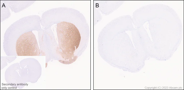 Immunohistochemistry (Formalin/PFA-fixed paraffin-embedded sections) - Anti-Tyrosine Hydroxylase (phospho S31) antibody [EPR26192-116] - BSA and Azide free (AB314485)