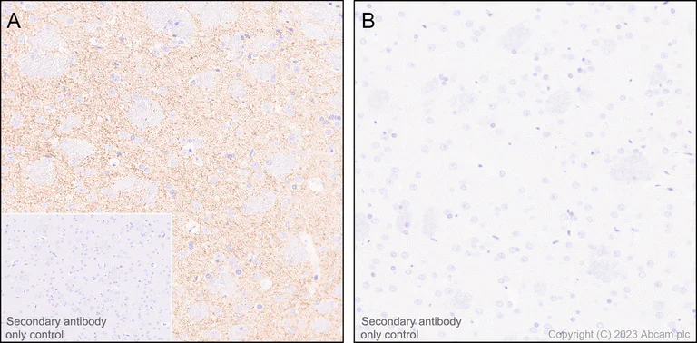 Immunohistochemistry (Formalin/PFA-fixed paraffin-embedded sections) - Anti-Tyrosine Hydroxylase (phospho S31) antibody [EPR26192-116] - BSA and Azide free (AB314485)