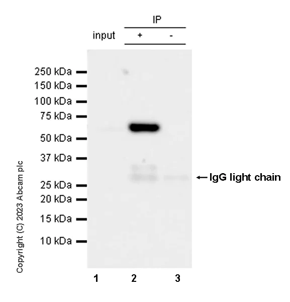 Immunoprecipitation - Anti-Tyrosine Hydroxylase (phospho S31) antibody [EPR26192-116] - BSA and Azide free (AB314485)