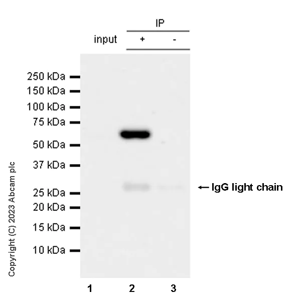 Immunoprecipitation - Anti-Tyrosine Hydroxylase (phospho S31) antibody [EPR26192-116] - BSA and Azide free (AB314485)