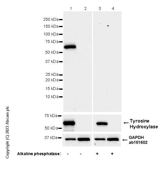 Western blot - Anti-Tyrosine Hydroxylase (phospho S31) antibody [EPR26192-116] - BSA and Azide free (AB314485)