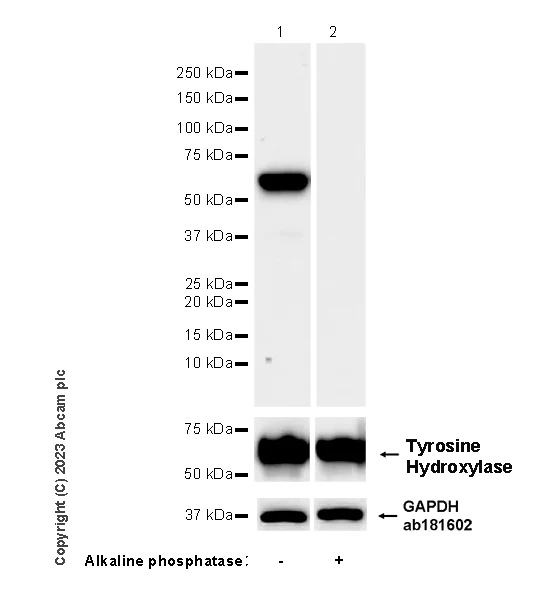 Western blot - Anti-Tyrosine Hydroxylase (phospho S31) antibody [EPR26192-116] - BSA and Azide free (AB314485)