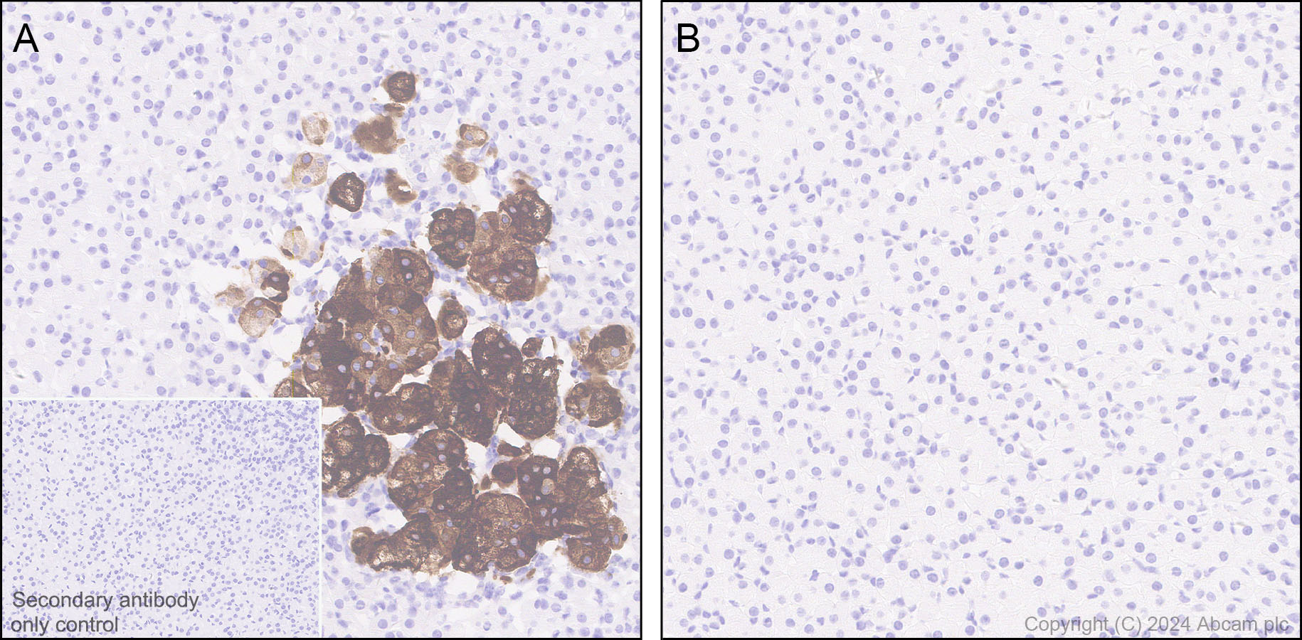 Immunohistochemistry (Formalin/PFA-fixed paraffin-embedded sections) - Anti-Tyrosine Hydroxylase (phospho S40) antibody [EPR26191-5] (AB316310), expandable thumbnail