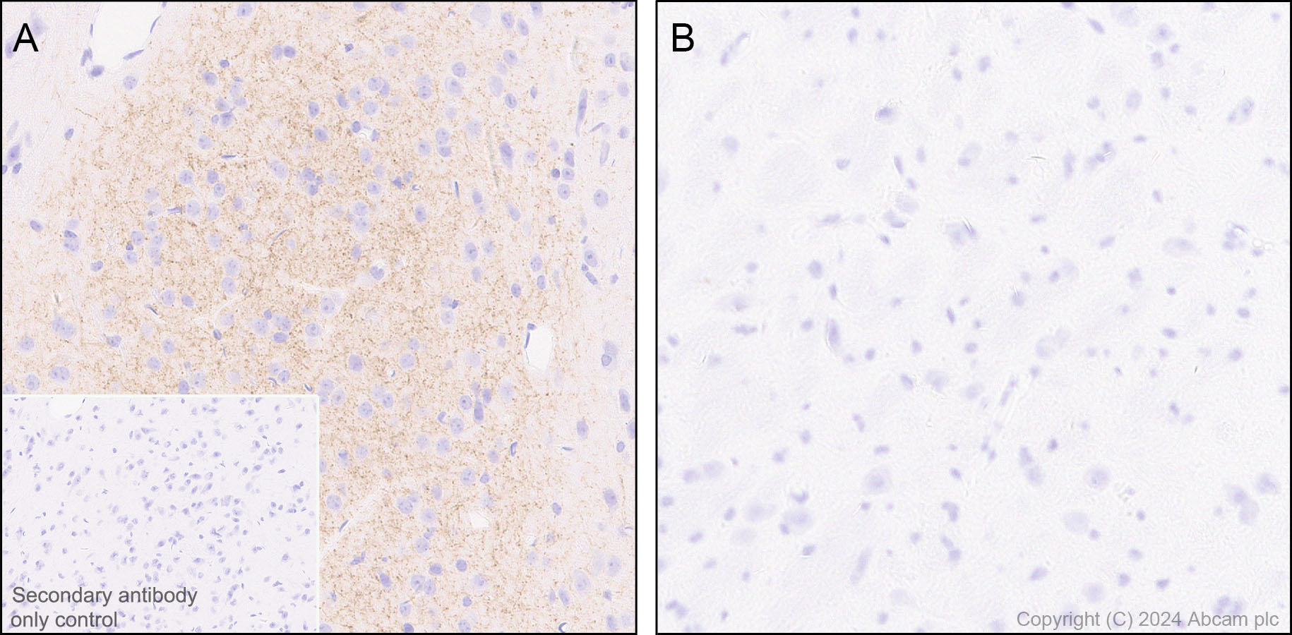 Immunohistochemistry (Formalin/PFA-fixed paraffin-embedded sections) - Anti-Tyrosine Hydroxylase (phospho S40) antibody [EPR26191-5] (AB316310), expandable thumbnail