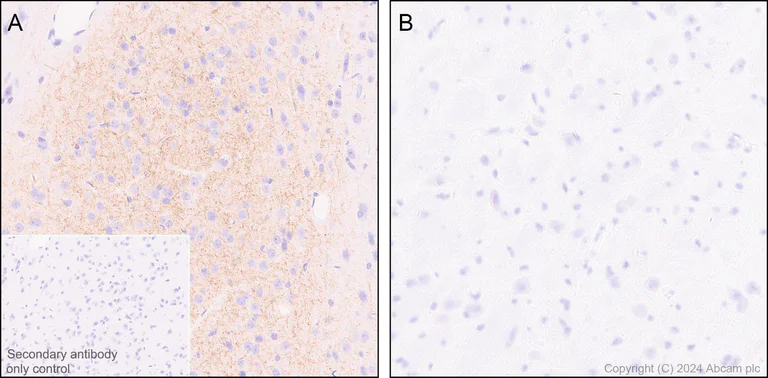 Immunohistochemistry (Formalin/PFA-fixed paraffin-embedded sections) - Anti-Tyrosine Hydroxylase (phospho S40) antibody [EPR26191-5] (AB316310)
