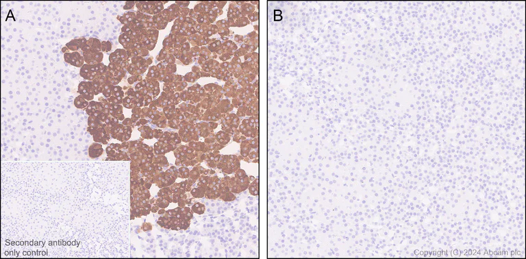 Immunohistochemistry (Formalin/PFA-fixed paraffin-embedded sections) - Anti-Tyrosine Hydroxylase (phospho S40) antibody [EPR26191-5] (AB316310)