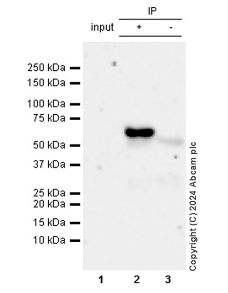 Immunoprecipitation - Anti-Tyrosine Hydroxylase (phospho S40) antibody [EPR26191-5] (AB316310), expandable thumbnail