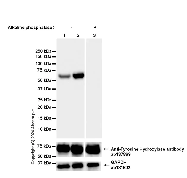Western blot - Anti-Tyrosine Hydroxylase (phospho S40) antibody [EPR26191-5] (AB316310)
