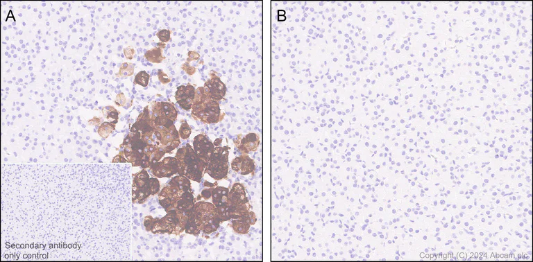 Immunohistochemistry (Formalin/PFA-fixed paraffin-embedded sections) - Anti-Tyrosine Hydroxylase (phospho S40) antibody [EPR26191-5] - BSA and Azide free (AB316311)