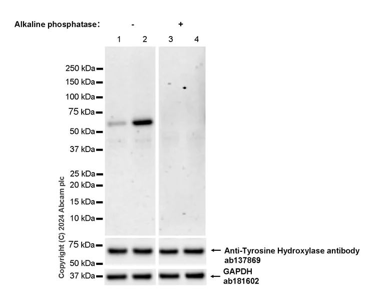 Western blot - Anti-Tyrosine Hydroxylase (phospho S40) antibody [EPR26191-5] - BSA and Azide free (AB316311)