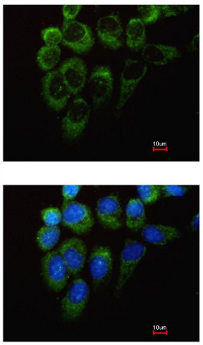 Immunocytochemistry/ Immunofluorescence - Anti-Tyrosyl tRNA synthetase/TyrRS antibody (AB155504)