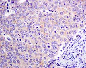 Immunohistochemistry (Formalin/PFA-fixed paraffin-embedded sections) - Anti-Tyrosyl tRNA synthetase/TyrRS antibody [EPR9926(B)] (AB150429)