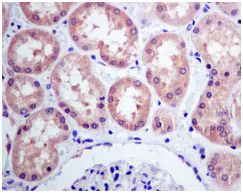 Immunohistochemistry (Formalin/PFA-fixed paraffin-embedded sections) - Anti-Tyrosyl tRNA synthetase/TyrRS antibody [EPR9926(B)] (AB150429)