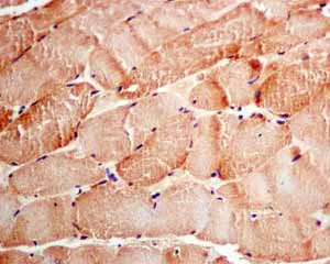 Immunohistochemistry (Formalin/PFA-fixed paraffin-embedded sections) - Anti-Tyrosyl tRNA synthetase/TyrRS antibody [EPR9926(B)] (AB150429)
