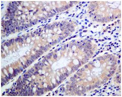 Immunohistochemistry (Formalin/PFA-fixed paraffin-embedded sections) - Anti-Tyrosyl tRNA synthetase/TyrRS antibody [EPR9926(B)] (AB150429)
