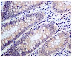 Immunohistochemistry (Formalin/PFA-fixed paraffin-embedded sections) - Anti-Tyrosyl tRNA synthetase/TyrRS antibody [EPR9926(B)] - BSA and Azide free (AB248985)