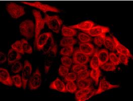 Immunocytochemistry/ Immunofluorescence - Anti-Tyrosyl tRNA synthetase/TyrRS antibody [EPR9927] - BSA and Azide free (AB249125), expandable thumbnail
