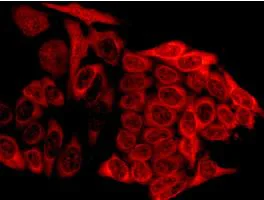 Immunocytochemistry/ Immunofluorescence - Anti-Tyrosyl tRNA synthetase/TyrRS antibody [EPR9927] - BSA and Azide free (AB249125)