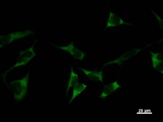 Immunocytochemistry - Anti-Tyrosyl tRNA synthetase/TyrRS antibody [YAR5H08] (AB50961), expandable thumbnail