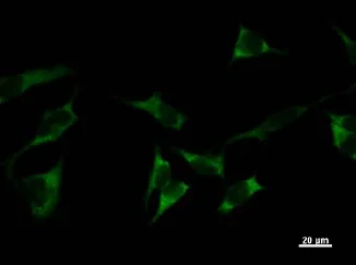 Immunocytochemistry - Anti-Tyrosyl tRNA synthetase/TyrRS antibody [YAR5H08] (AB50961)