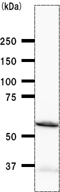 Western blot - Anti-Tyrosyl tRNA synthetase/TyrRS antibody [YAR5H08] (AB50961)