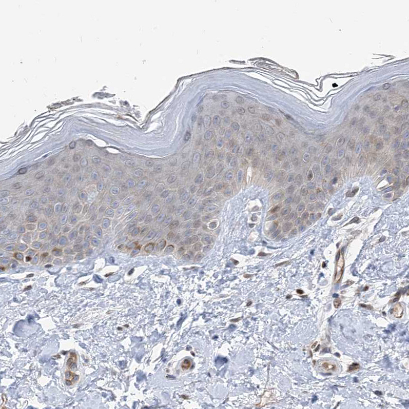 Immunohistochemistry (Formalin/PFA-fixed paraffin-embedded sections) - Anti-TYSND1 antibody (AB122106)