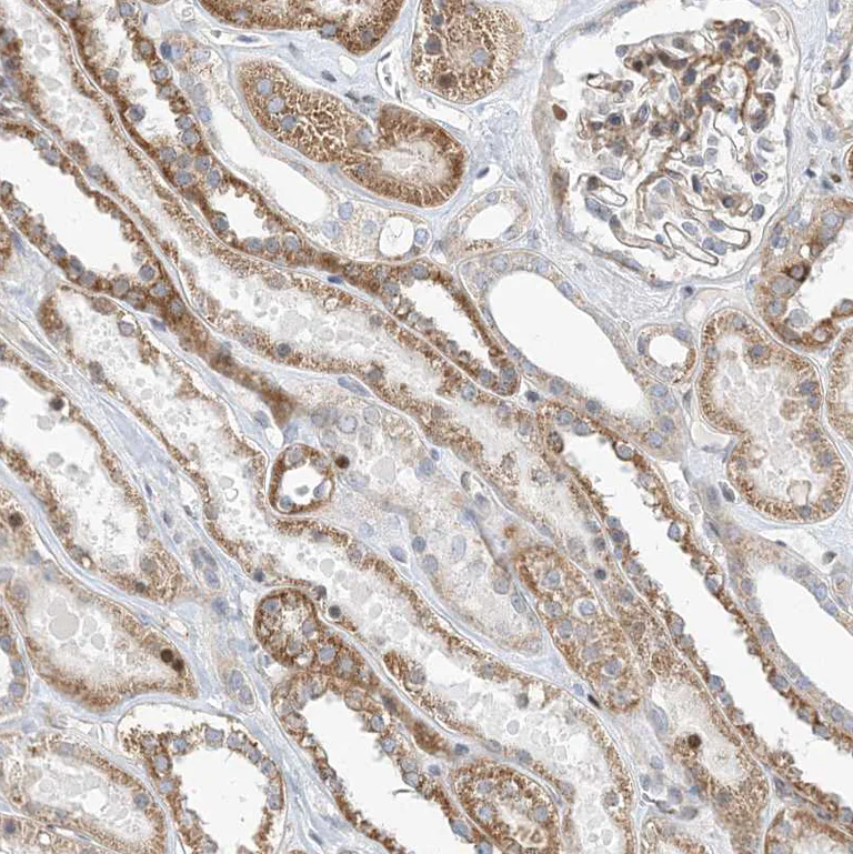 Immunohistochemistry (Formalin/PFA-fixed paraffin-embedded sections) - Anti-TYSND1 antibody (AB122106)
