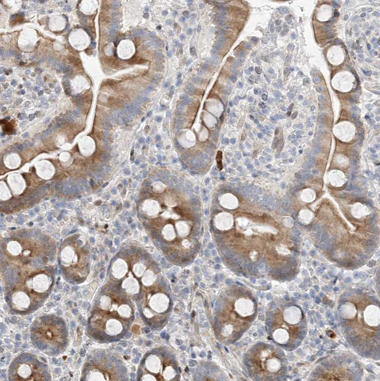 Immunohistochemistry (Formalin/PFA-fixed paraffin-embedded sections) - Anti-TYSND1 antibody (AB122106)