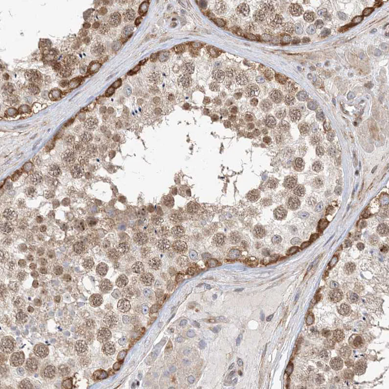 Immunohistochemistry (Formalin/PFA-fixed paraffin-embedded sections) - Anti-TYSND1 antibody (AB122106)