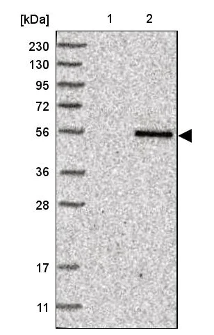 Western blot - Anti-TYSND1 antibody (AB122106)