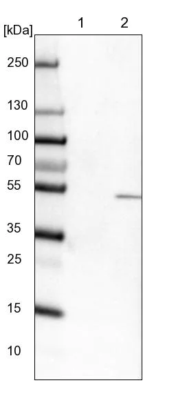 Western blot - Anti-TYSND1 antibody (AB122106)