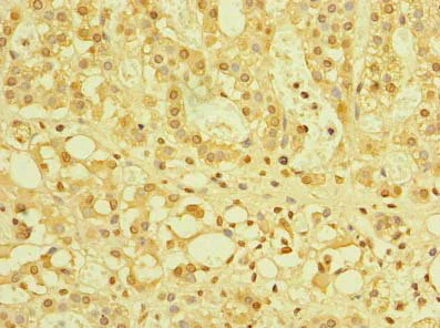 Immunohistochemistry (Formalin/PFA-fixed paraffin-embedded sections) - Anti-TZFP/ZBTB32 antibody (AB235306)