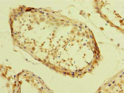 Immunohistochemistry (Formalin/PFA-fixed paraffin-embedded sections) - Anti-TZFP/ZBTB32 antibody (AB235306)